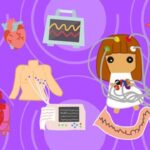 Udemy Gratis: Curso básico de electrocardiografía