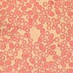 Udemy Gratis: Introducción a la lectura de extendidos sanguíneos